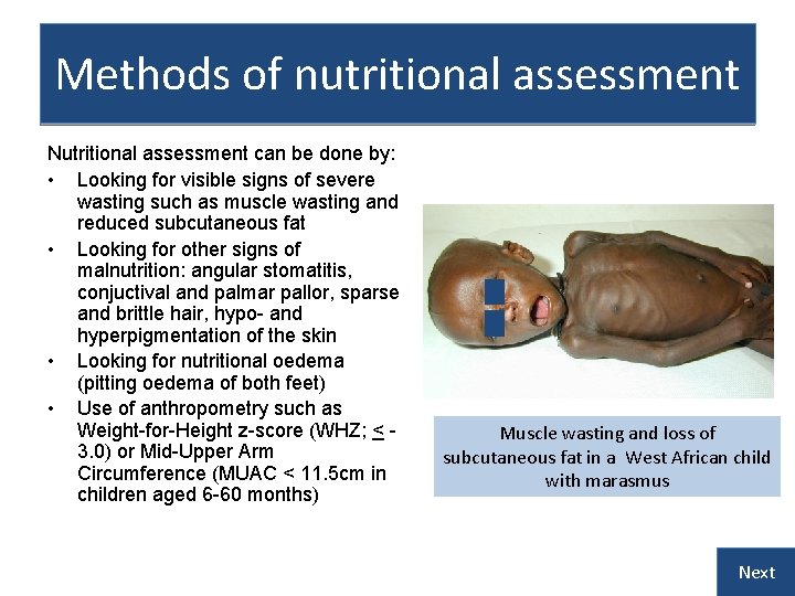 Methods of nutritional assessment Nutritional assessment can be done by: • Looking for visible