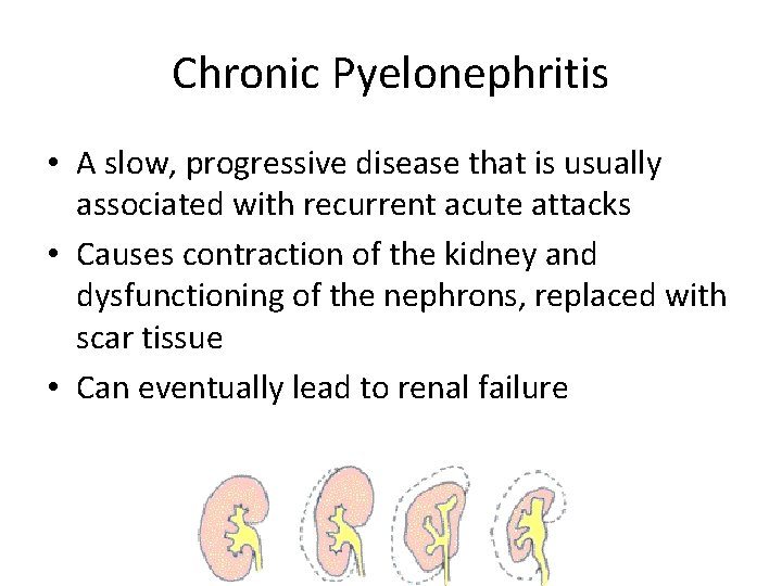 Chronic Pyelonephritis • A slow, progressive disease that is usually associated with recurrent acute