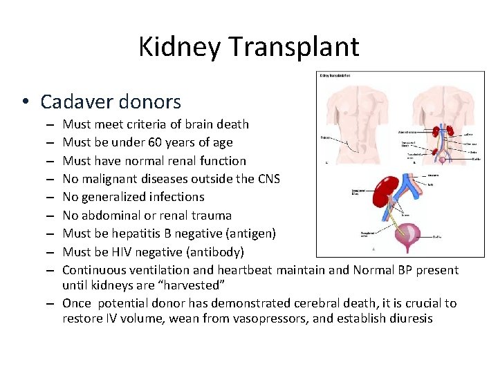 Kidney Transplant • Cadaver donors Must meet criteria of brain death Must be under