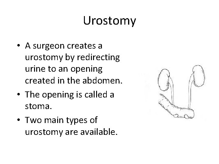 Urostomy • A surgeon creates a urostomy by redirecting urine to an opening created