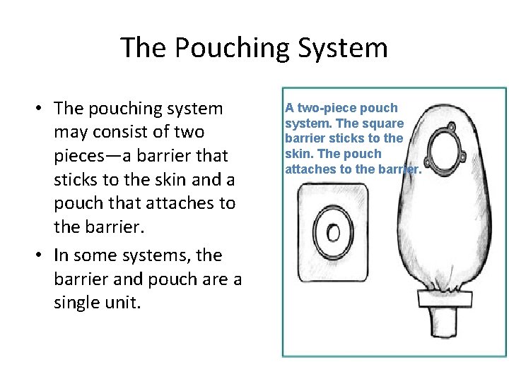 The Pouching System • The pouching system may consist of two pieces—a barrier that