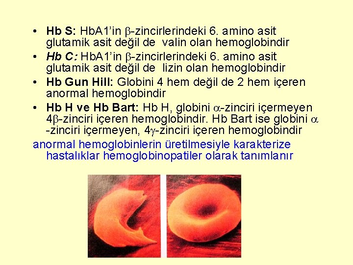  • Hb S: Hb. A 1’in -zincirlerindeki 6. amino asit glutamik asit değil