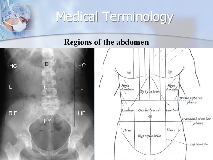Medical Terminology Regions of the abdomen 