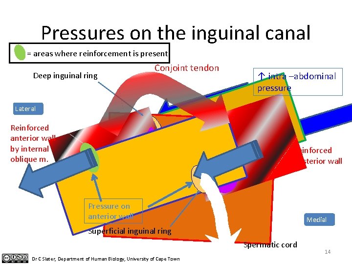 Pressures on the inguinal canal = areas where reinforcement is present Deep inguinal ring