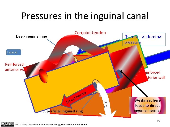 Pressures in the inguinal canal Conjoint tendon Deep inguinal ring ↑ intra –abdominal pressure