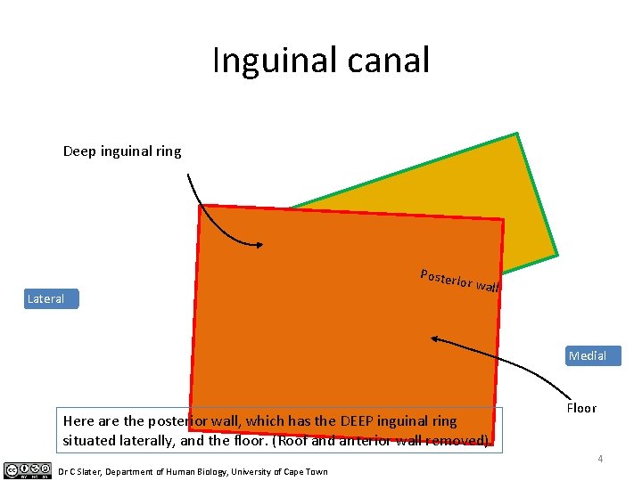 Inguinal canal Deep inguinal ring Posteri Lateral or wall Medial Here are the posterior