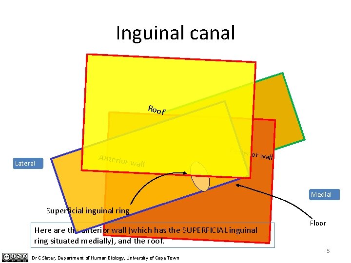 Inguinal canal Roof Lateral Anterio r wall Posteri or wall Medial Superficial inguinal ring