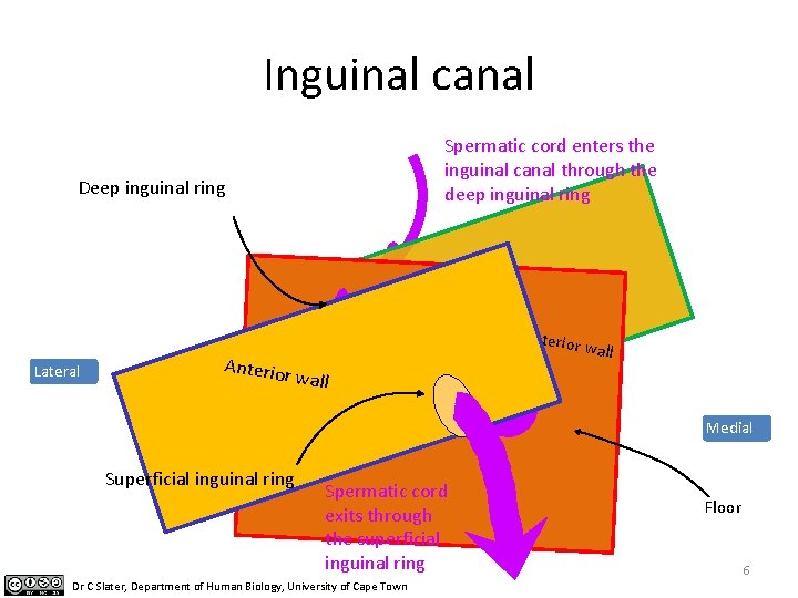 Inguinal canal Spermatic cord enters the inguinal canal through the deep inguinal ring Deep