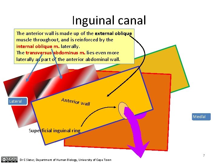 Inguinal canal The anterior wall is made up of the external oblique muscle throughout,