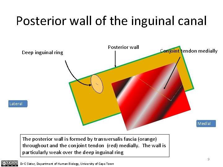 Posterior wall of the inguinal canal Deep inguinal ring Posterior wall Conjoint tendon medially