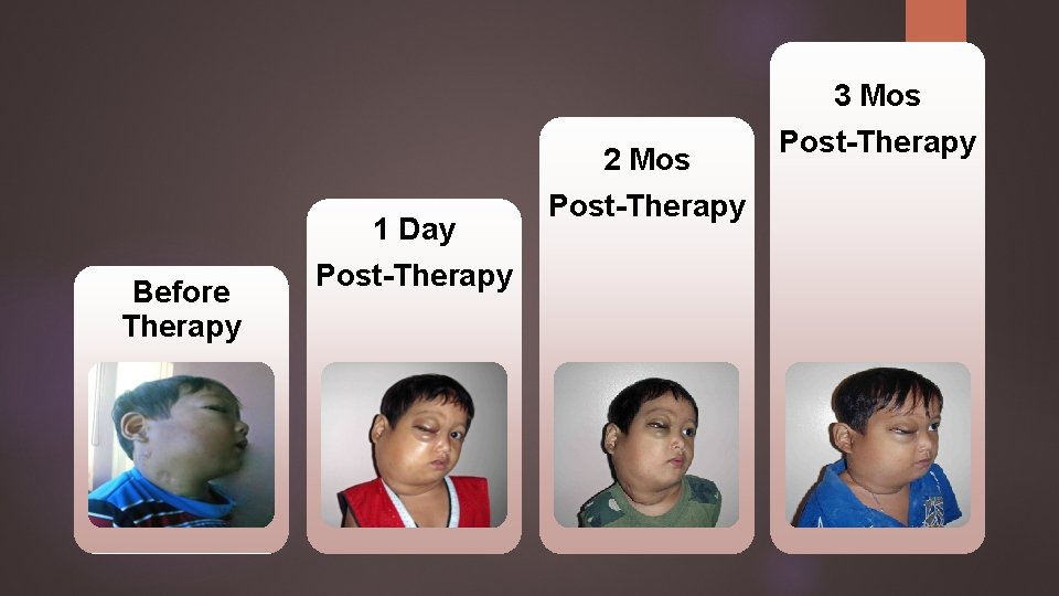 3 Mos 2 Mos 1 Day Before Therapy Post-Therapy 