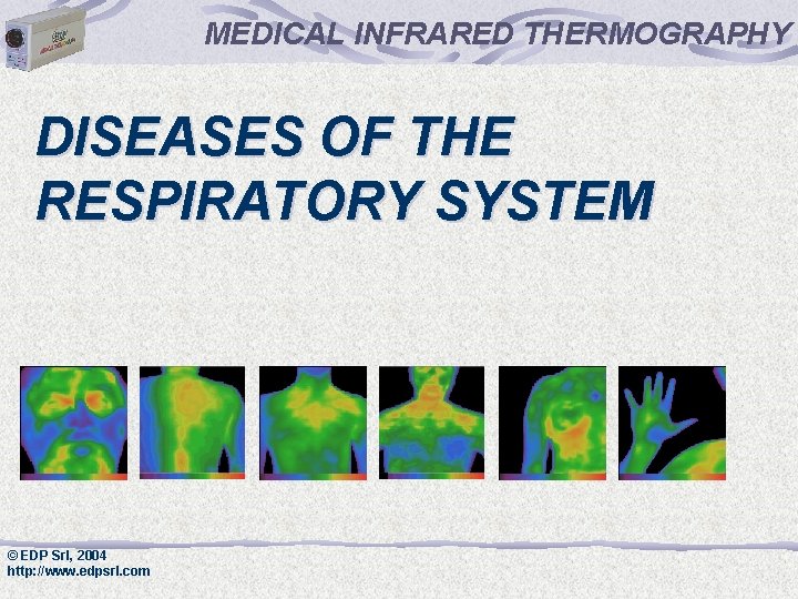 MEDICAL INFRARED THERMOGRAPHY DISEASES OF THE RESPIRATORY SYSTEM © EDP Srl, 2004 http: //www.
