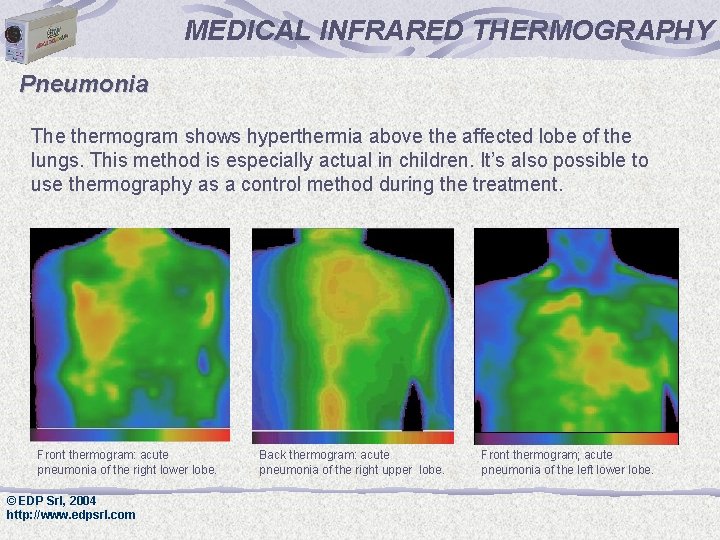 MEDICAL INFRARED THERMOGRAPHY DISEASES OF THE RESPIRATORY SYSTEM