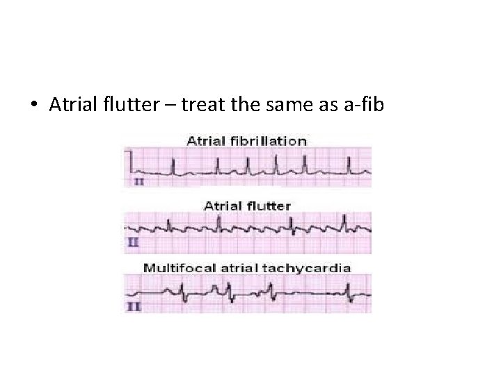  • Atrial flutter – treat the same as a-fib 