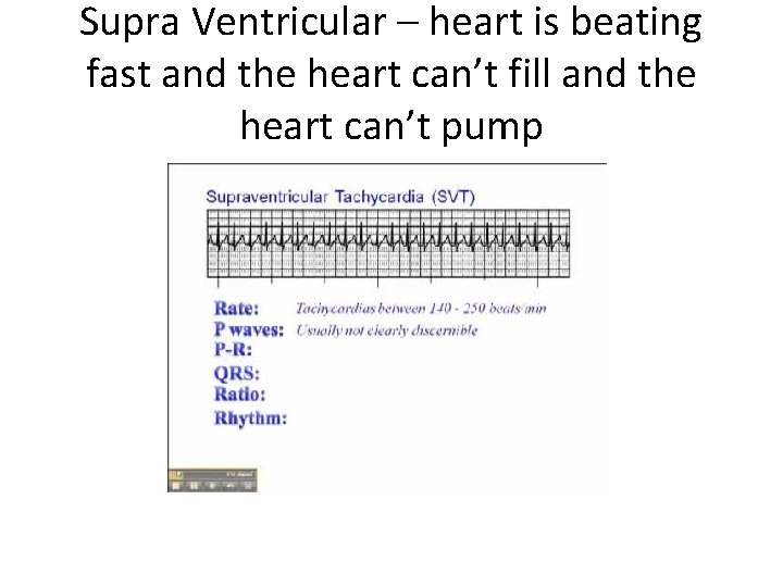 Supra Ventricular – heart is beating fast and the heart can’t fill and the