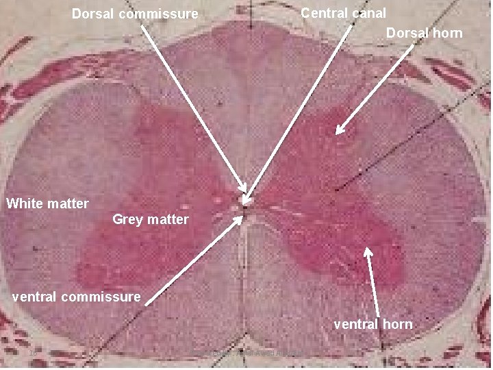 Dorsal commissure Central canal Dorsal horn White matter Grey matter ventral commissure ventral horn