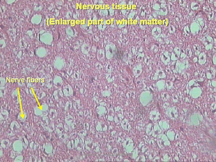 Nervous tissue (Enlarged part of white matter) Nerve fibers 17 Prepared by : Amal Nervous tissue (Enlarged part of white matter) Nerve fibers 17 Prepared by : Amal