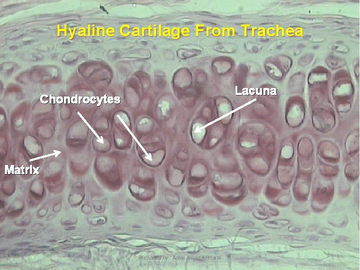 Hyaline Cartilage From Trachea Lacuna Chondrocytes Matrix 8 Prepared by : Amal Awad Al-Harbi