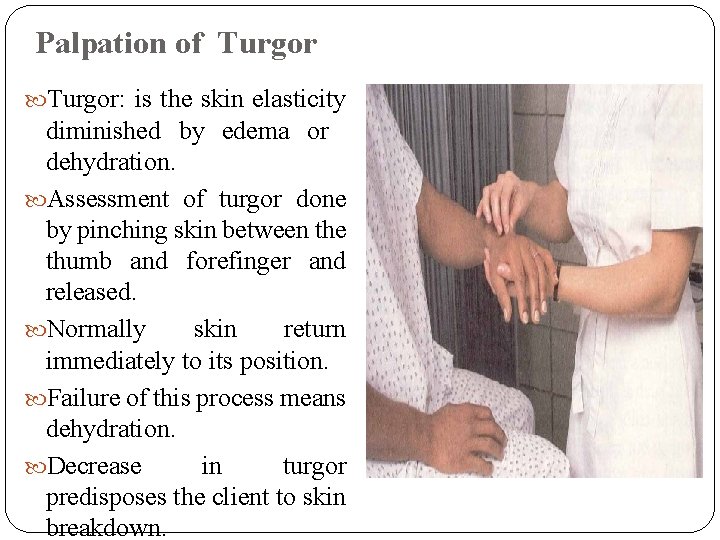 Palpation of Turgor: is the skin elasticity diminished by edema or dehydration. Assessment of