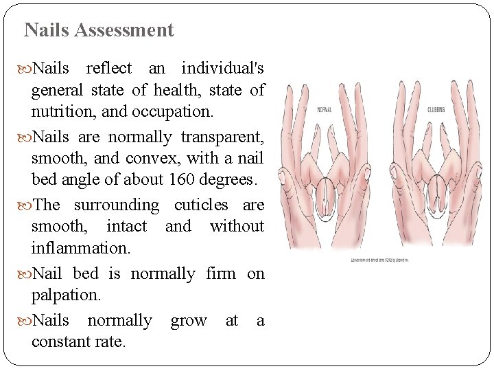 Nails Assessment Nails reflect an individual's general state of health, state of nutrition, and