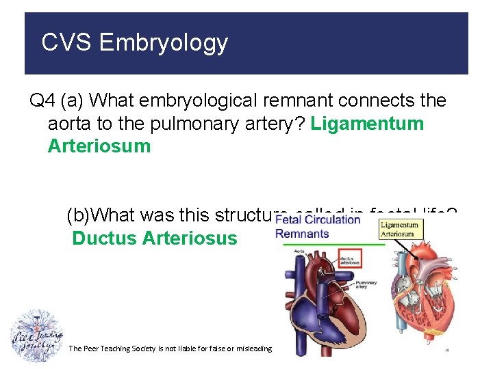 CVS Embryology Q 4 (a) What embryological remnant connects the aorta to the pulmonary