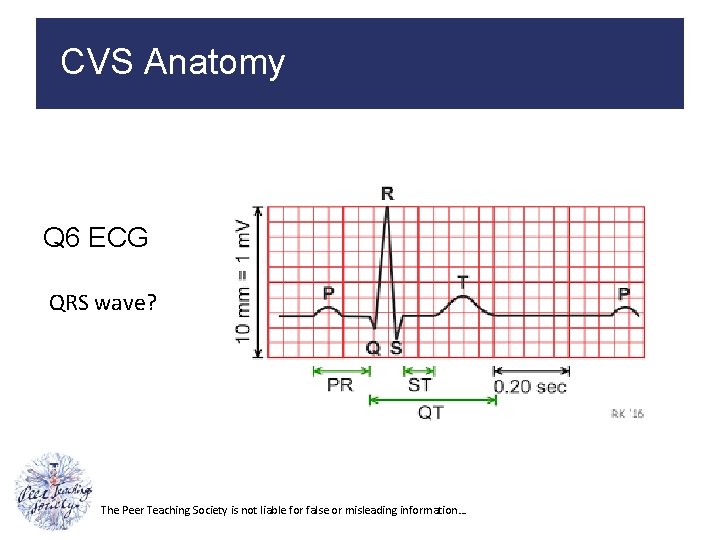 CVS Anatomy Q 6 ECG QRS wave? The Peer Teaching Society is not liable