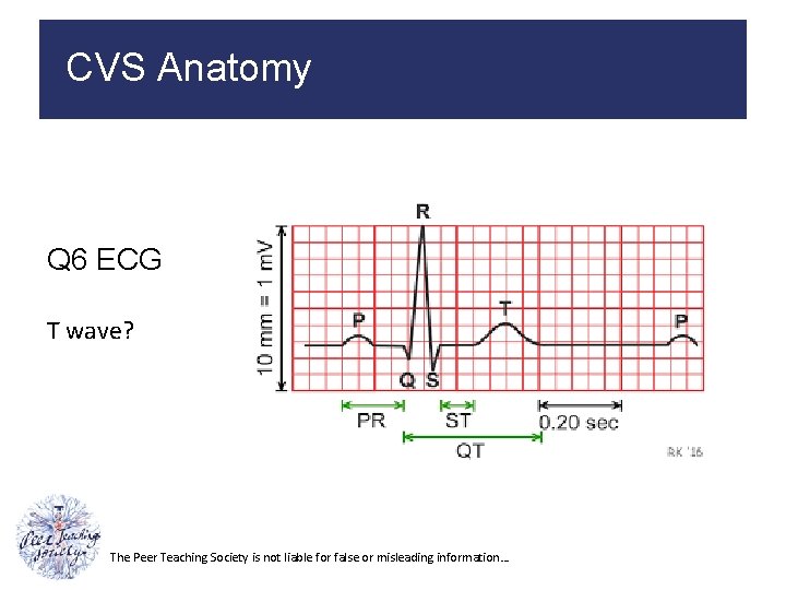 CVS Anatomy Q 6 ECG T wave? The Peer Teaching Society is not liable