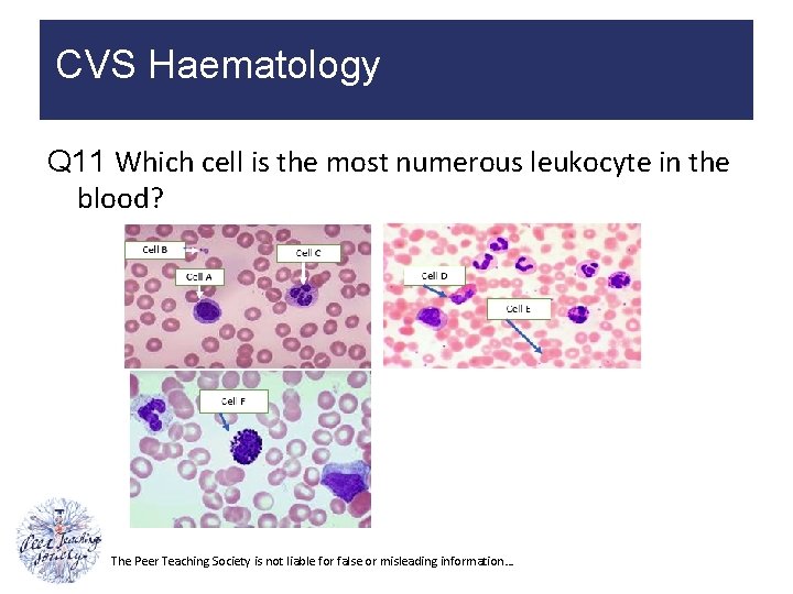 CVS Haematology Q 11 Which cell is the most numerous leukocyte in the blood?