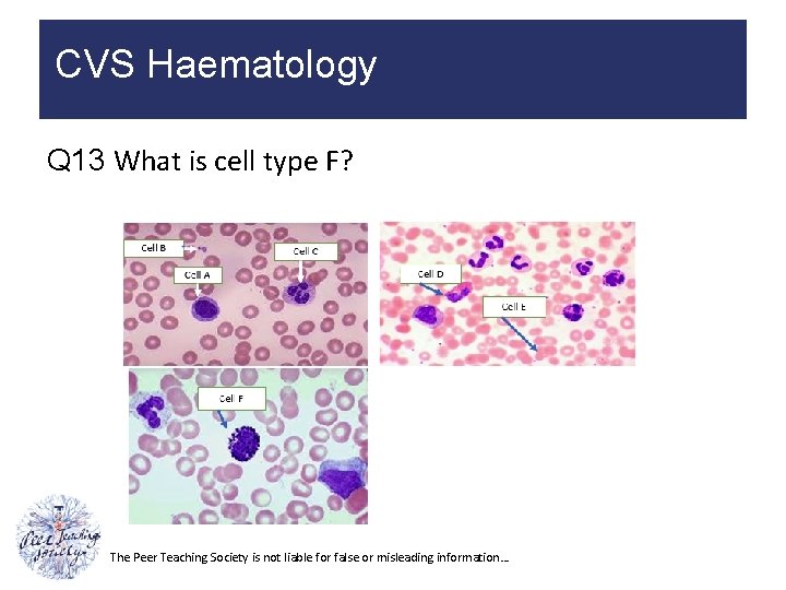 CVS Haematology Q 13 What is cell type F? The Peer Teaching Society is