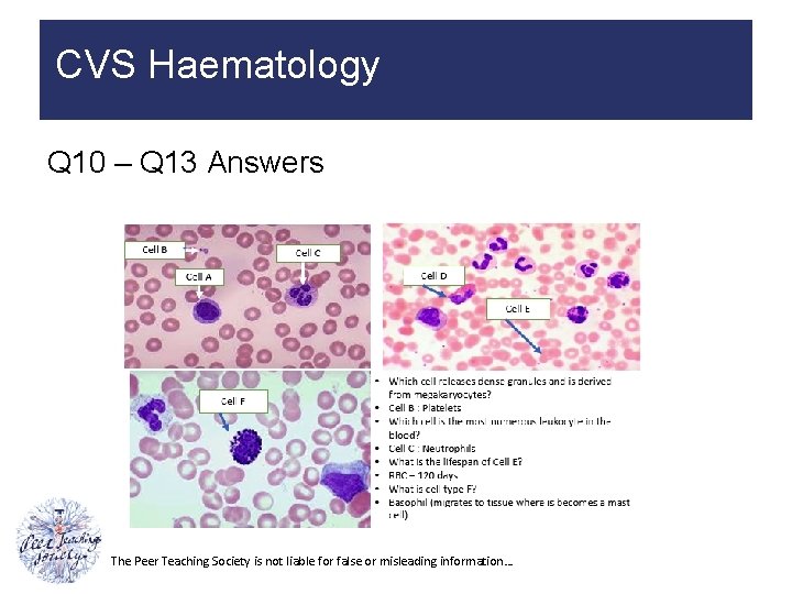 CVS Haematology Q 10 – Q 13 Answers The Peer Teaching Society is not