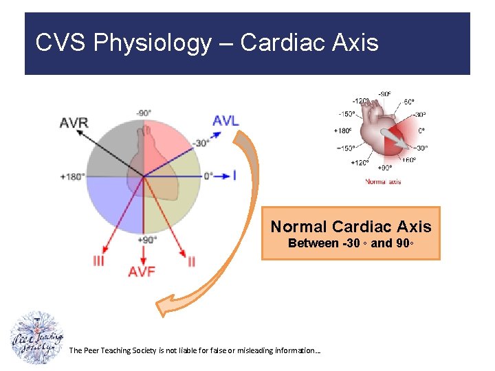 CVS Physiology – Cardiac Axis Normal Cardiac Axis Between -30 ◦ and 90◦ The