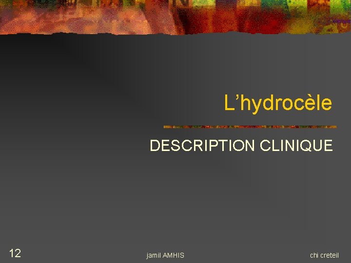 L’hydrocèle DESCRIPTION CLINIQUE 12 jamil AMHIS chi creteil L’hydrocèle DESCRIPTION CLINIQUE 12 jamil AMHIS chi creteil