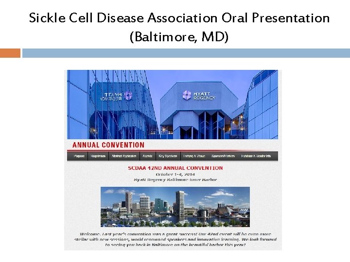 Sickle Cell Disease Association Oral Presentation (Baltimore, MD) Sickle Cell Disease Association Oral Presentation (Baltimore, MD)