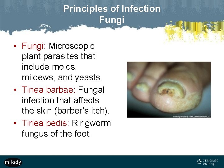 Principles of Infection Fungi • Fungi: Microscopic plant parasites that include molds, mildews, and