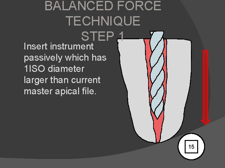 BALANCED FORCE TECHNIQUE STEP 1 Insert instrument passively which has 1 ISO diameter larger