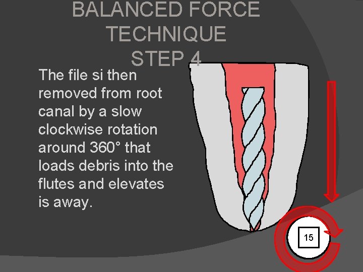 BALANCED FORCE TECHNIQUE STEP 4 The file si then removed from root canal by