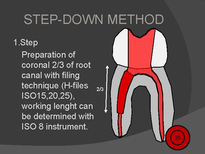 STEP-DOWN METHOD 1. Step Preparation of coronal 2/3 of root canal with filing technique