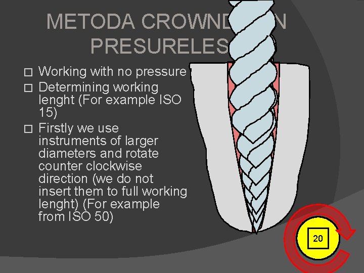 METODA CROWNDOWN PRESURELESS Working with no pressure Determining working lenght (For example ISO 15)