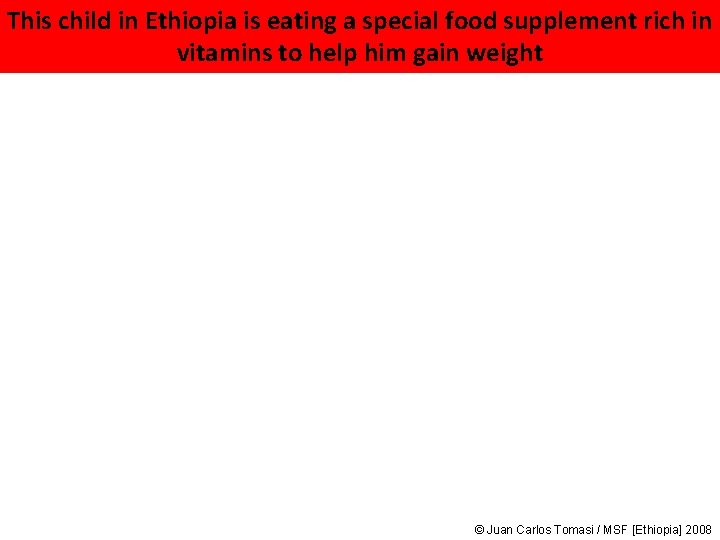 This child in Ethiopia is eating a special food supplement rich in vitamins to This child in Ethiopia is eating a special food supplement rich in vitamins to