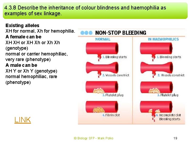 4. 3. 8 Describe the inheritance of colour blindness and haemophilia as examples of