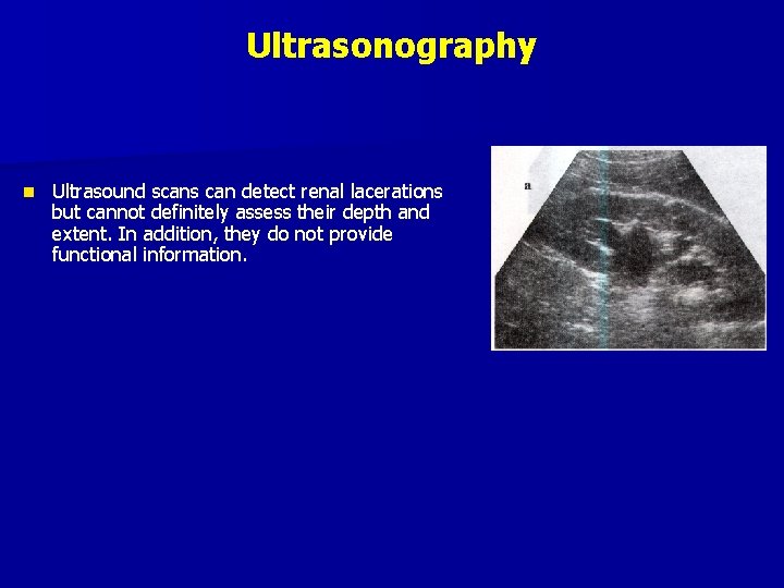 Ultrasonography n Ultrasound scans can detect renal lacerations but cannot definitely assess their depth