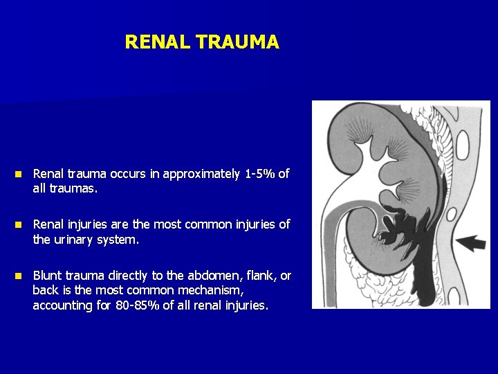 RENAL TRAUMA n Renal trauma occurs in approximately 1 -5% of all traumas. n