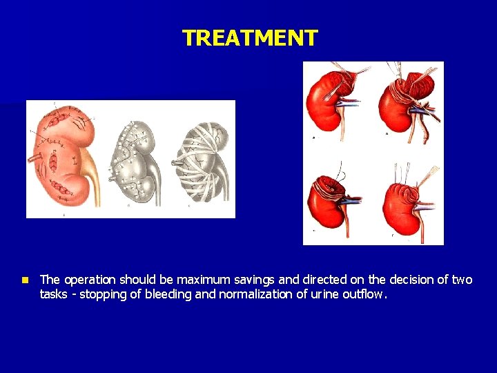 TREATMENT n The operation should be maximum savings and directed on the decision of