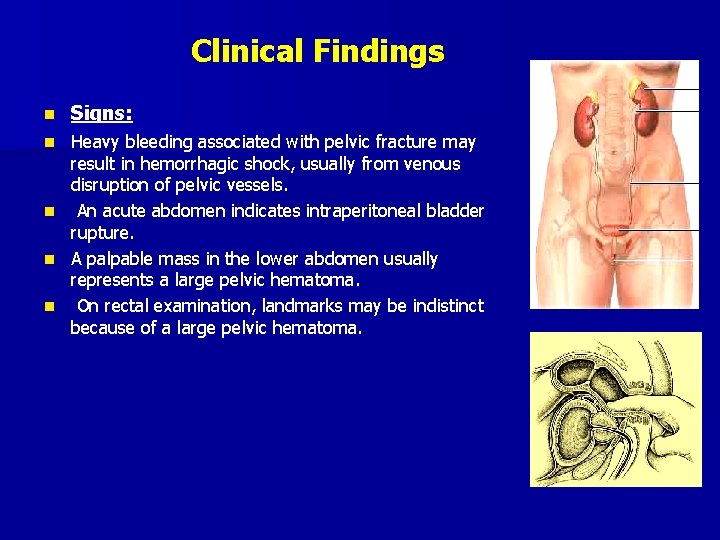 Clinical Findings n Signs: Heavy bleeding associated with pelvic fracture may result in hemorrhagic