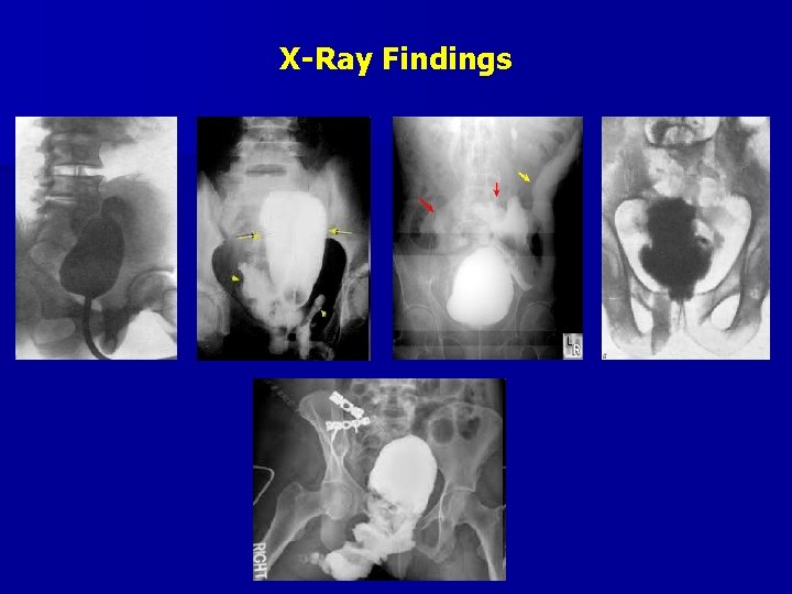 X-Ray Findings 