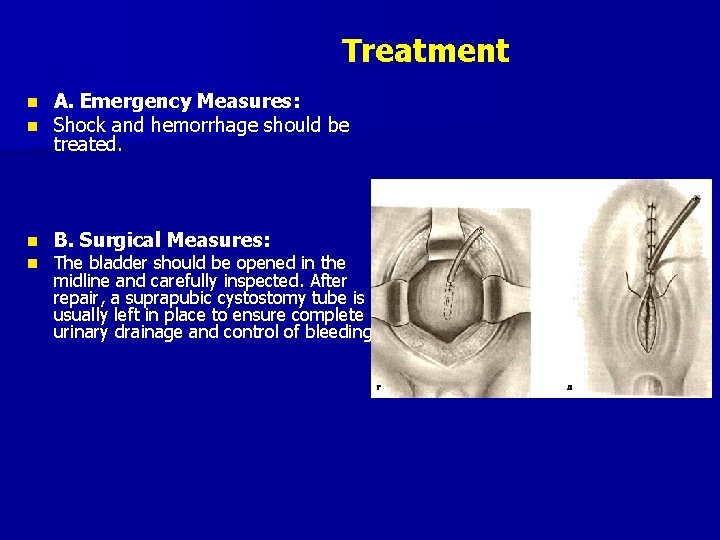 Treatment n n A. Emergency Measures: Shock and hemorrhage should be treated. n B.