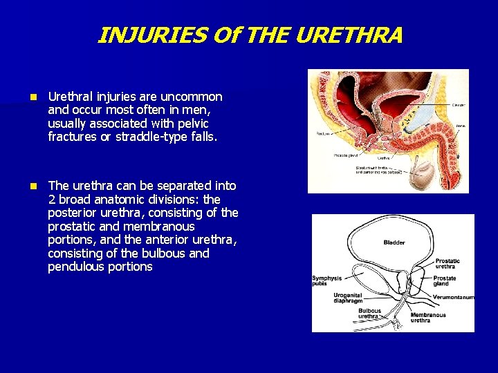 INJURIES Of THE URETHRA n Urethral injuries are uncommon and occur most often in