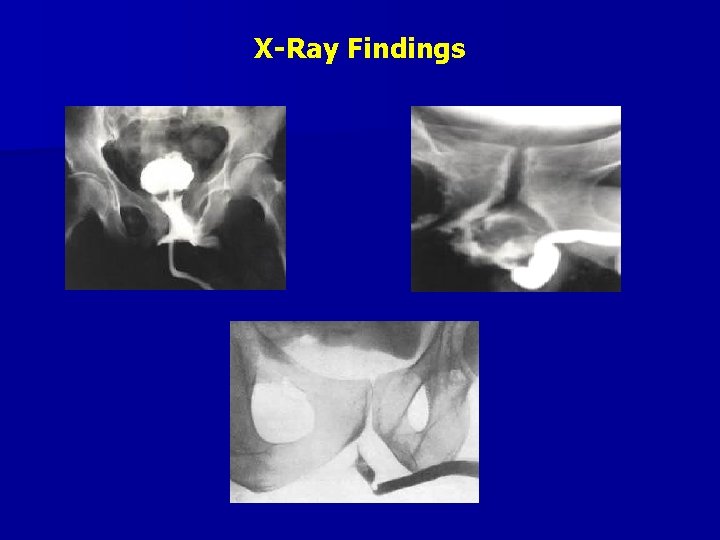 X-Ray Findings 