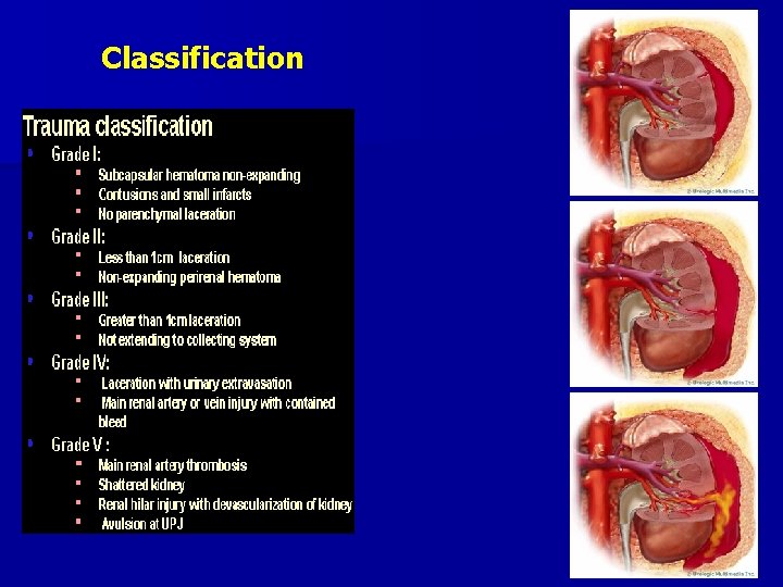 Classification 