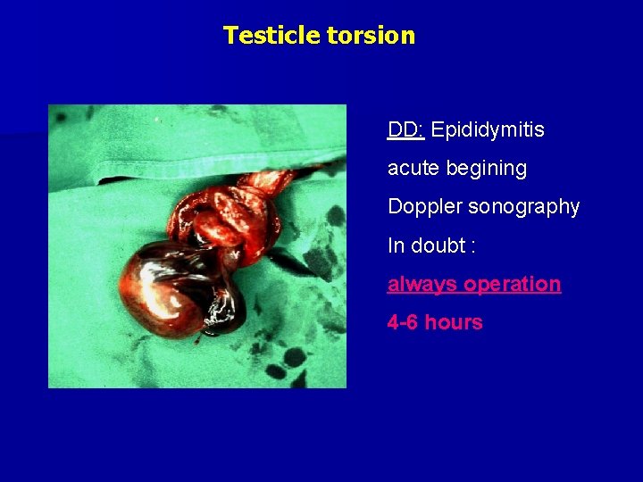 Testicle torsion DD: Epididymitis acute begining Doppler sonography In doubt : always operation 4